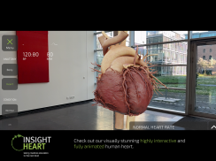 INSIGHT HEART screenshot 10