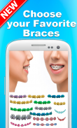 Braces Camera Selfie - Photo Editor screenshot 1