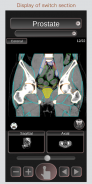 CT PassportLite Abdomen / sectional anatomy / MRI screenshot 2