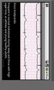 Electrocardiogram ECG Types screenshot 2