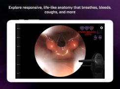 Airway Ex - Intubate. Anesthetize. Train. screenshot 20