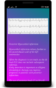 ECG (EKG) Interpretación screenshot 4