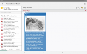 STS Cardiothoracic Surgery screenshot 10