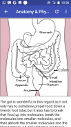 Appendicitis screenshot 0