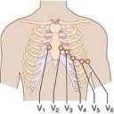 Clinical ECG Guide.