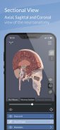 AppSurgeOn - 3D Skull Atlas screenshot 7