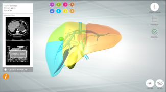 LIVER-NOTE.Edu screenshot 7