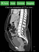 Radiology CT Viewer screenshot 7