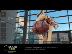 INSIGHT HEART screenshot 13