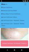 Cold Sore Cure Free App with Natural Remedies screenshot 6