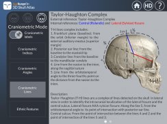 3D Skull Atlas screenshot 9