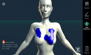 3D Burn Resuscitation screenshot 5