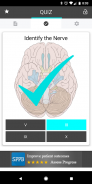 Cranial Nerves Flashcards screenshot 4