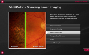 SPECTRALIS OCT screenshot 4