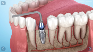 Dental 3D Illustrations screenshot 12