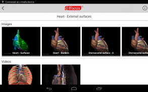 HEART - Digital Anatomy Atlas screenshot 1