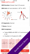 ECG FlashCards 2 Lite - Free Reference EKG App screenshot 11