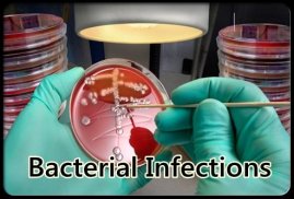 Bacterial Infections screenshot 0