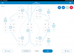 Ceva Lung Program screenshot 2