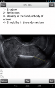 Ultrasound Flashcards Boards Flashcards Lite screenshot 10