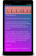 ECG (EKG) Interpretación screenshot 3