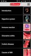 Inflammatory Bowel Disease screenshot 7