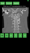 CT Cervical Spine screenshot 0