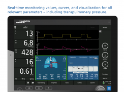 HAMILTON-C6 ventilator and patient simulation screenshot 2