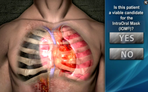 DeviceDrills: NuMask CPR IOM® screenshot 1