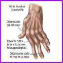 Remedios Caseros Artritis Icon