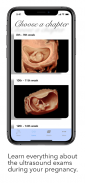 ScanBaby learn baby ultrasound screenshot 6