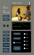 心电图节律和脉搏 screenshot 10