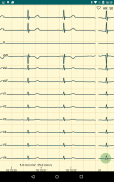 DiaCard - ECG Recorder screenshot 7