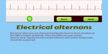 ECG Rhythm Quiz screenshot 5