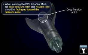 DeviceDrills: NuMask CPR IOM® screenshot 3