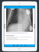 CXR FlashCards - Reference app for Chest X-rays screenshot 5