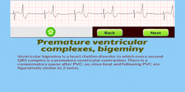 ECG Rhythm Quiz screenshot 4