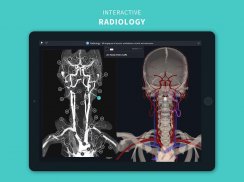 Complete Anatomy 19 for Android screenshot 4