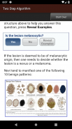 Dermoscopy Two Step Algorithm screenshot 19