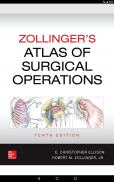 Zollinger's Surgery Atlas 10/E screenshot 20
