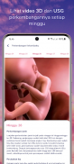 BukuBumil - Pregnancy Tracker screenshot 19