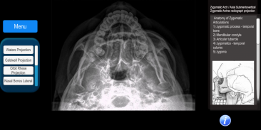 Radiographic Anatomy X-Ray screenshot 3