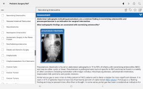 APSA Pediatric Surgery Library screenshot 4