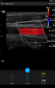 Philips Lumify Ultrasound App screenshot 1