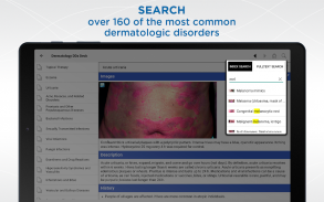 Dermatology DDx screenshot 5