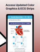 ECG EKG Interpretation Mastery screenshot 14