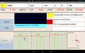 Mobile patient monitoring screenshot 3