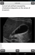 Ultrasound Flashcards Boards Flashcards Lite screenshot 22