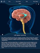 Nervous System Anatomy Pro. screenshot 9