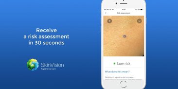 SkinVision - Detect Skin Cancer screenshot 4